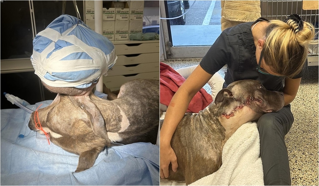 King Before And After His Tumor Got Removed